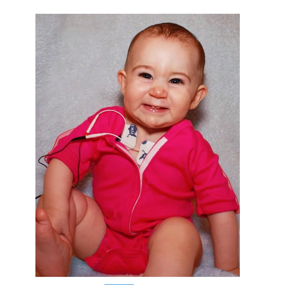 Girls Medical & G-Tube Accessible Short One-Piece Bodysuit - TheraplayKids